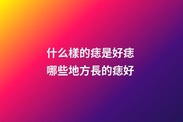 什么樣的痣是好痣 哪些地方長的痣好